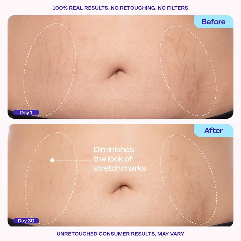 New! GOPURE Tighten & Smooth Belly Firming Cream